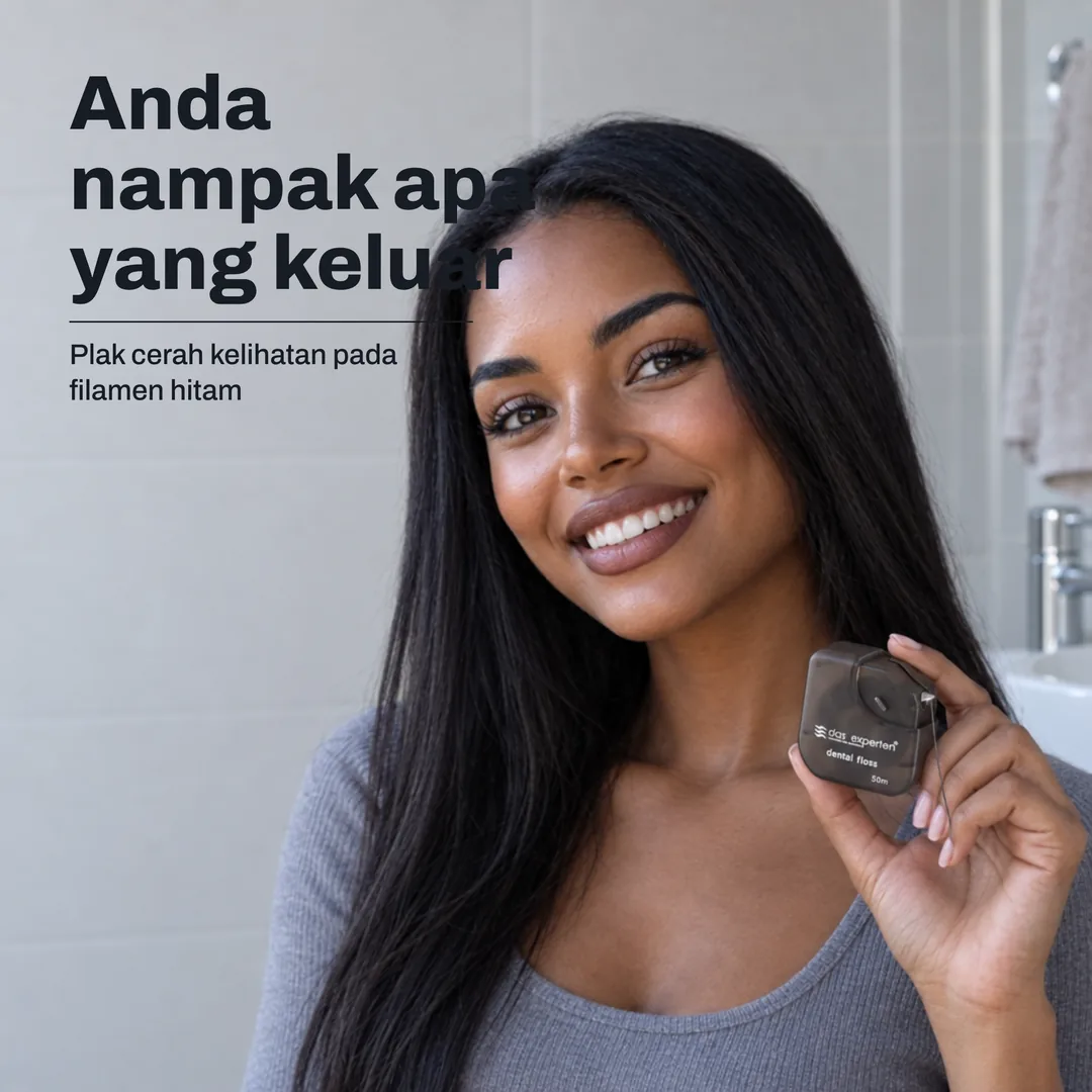 Anda nampak apa yang keluar — Plak cerah kelihatan pada filamen hitam
