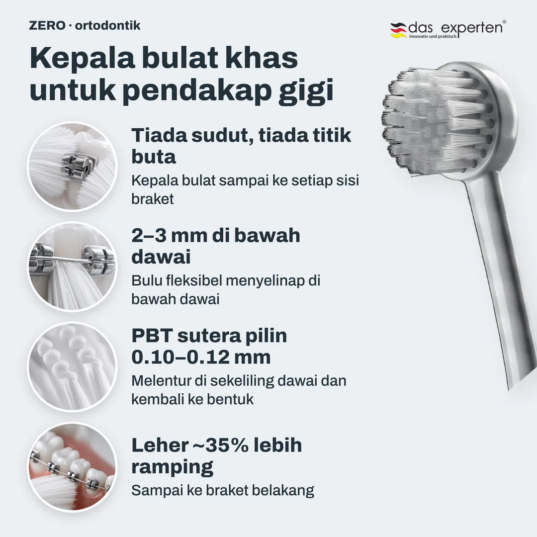 Kepala bulat khas untuk pendakap gigi — Tiada sudut, tiada titik buta; 2–3 mm di bawah dawai; PBT sutera pilin 0.10–0.12 mm; Leher ~35% lebih ramping